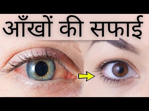 वीडियो: मैं अपनी खिड़की को चमकदार कैसे बनाऊं?