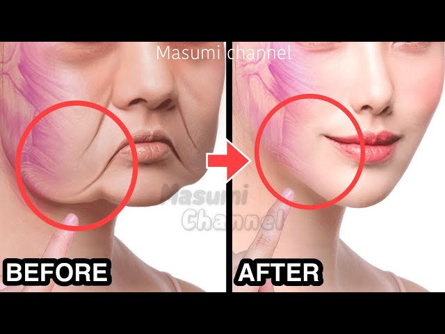 BEST ANTI-AGING FACE LIFTING EXERCISE AT HOME🔥 | LOOK YOUNGER, TIGHTEN SKIN, REDUCE WRINKLES class=