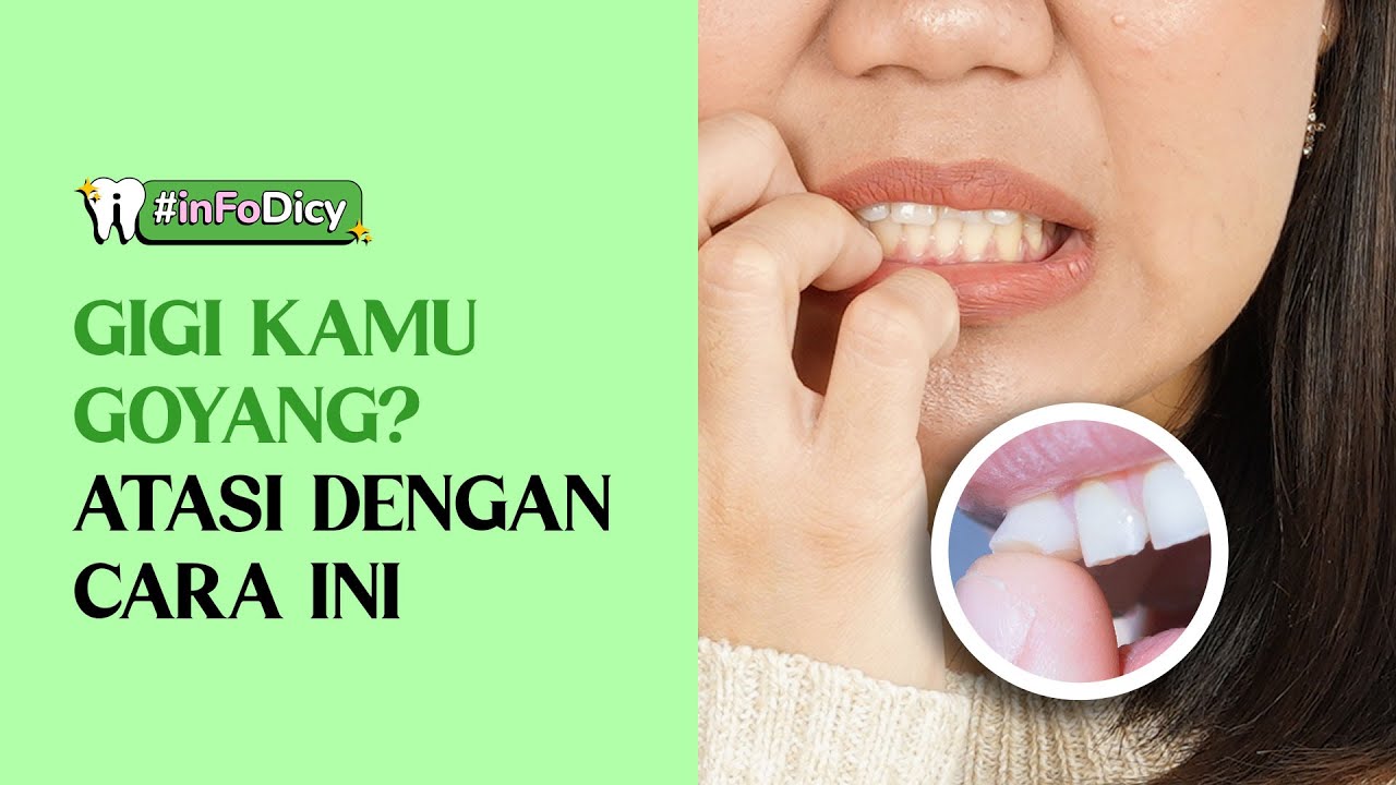 CARA MENGATASI GIGI GOYANG | #INFODICY - YouTube