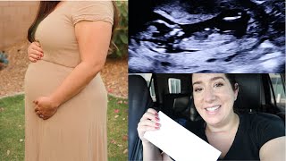 Nipt Results 12 Week Ultrasound & Gender ???