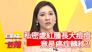 私密處紅腫長大痘痘,竟是癌症轉移?!【#醫師好辣】20201210 part1 EP1065 陳依依 田知學