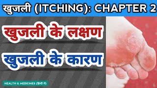 Khujli Ke Karan | Reason of Itching in Hindi | Symptoms of Itchy Skin | खुजली के कारण