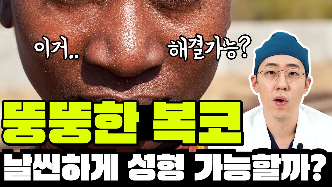 뚱뚱한 복코(주먹코) 날씬하게 성형 가능할까?  진단부터 수술방법까지 확실하게 알아보자!     #복코 #코성형 #주먹코