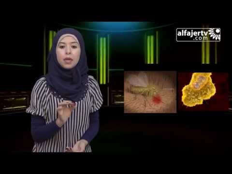 برنامج صباح الخير اللشمانيا بين الاعراض وطرق العلاج