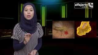 برنامج صباح الخير - اللشمانيا بين الاعراض وطرق العلاج