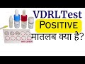 VDRL Test Hindi VDRL Test Kya Hota Hai