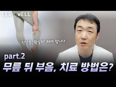 무릎 뒤가 부었을 때, 치료 방법은? 오금이 부은 걸 방치하면 위험한 이유. |강남하지정맥류병원 레그웰의원