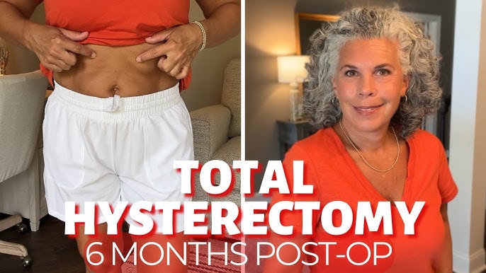 laparoscopic hysterectomy before and after