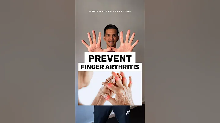 Prevent finger arthritis with these exercises! #arthritis