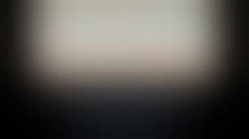 Underwater EMR for 2cm flat polyp at sigmoid colon