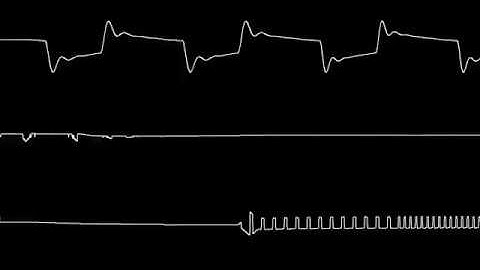 [C64] Assembloids theme – oscilloscope view