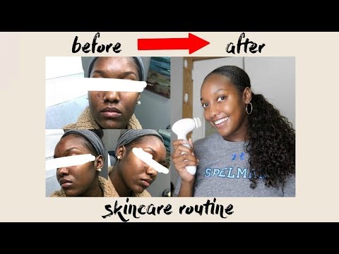 SKINCARE ROUTINE  | How To Clear Acne, Dark Spots, + Hyper-pigmentation FAST!! IN-DEPTH