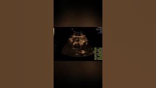 BUAH HATIKU - PABLO BENUA  LAGU POP INDONESIA 2021