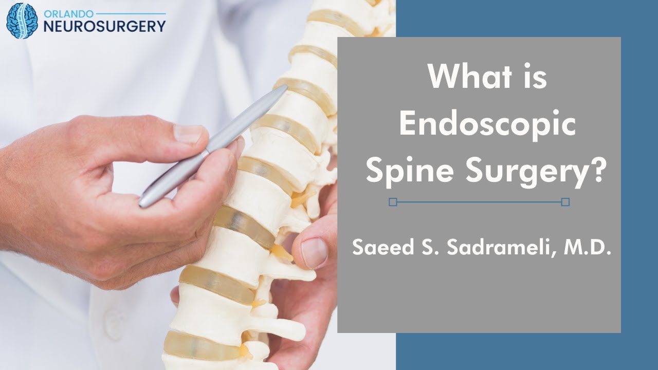 What is Endoscopic Spine Surgery? Saeed S. Sadrameli, M.D. YouTube