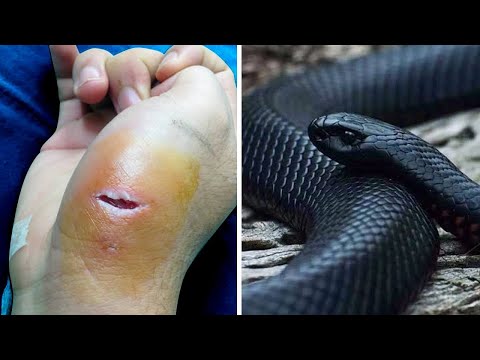 Video: ¿Cuál es la serpiente más venenosa del mundo?