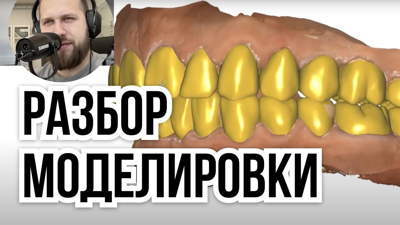 EXOCAD modelling проверка работ зубного техника. Обучение EXOCAD зубной техник обучени е моделир