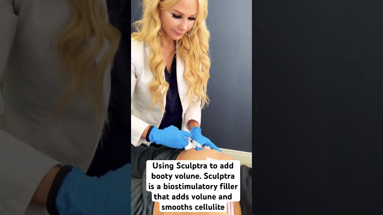 Sculptra for booty volume 🍑 