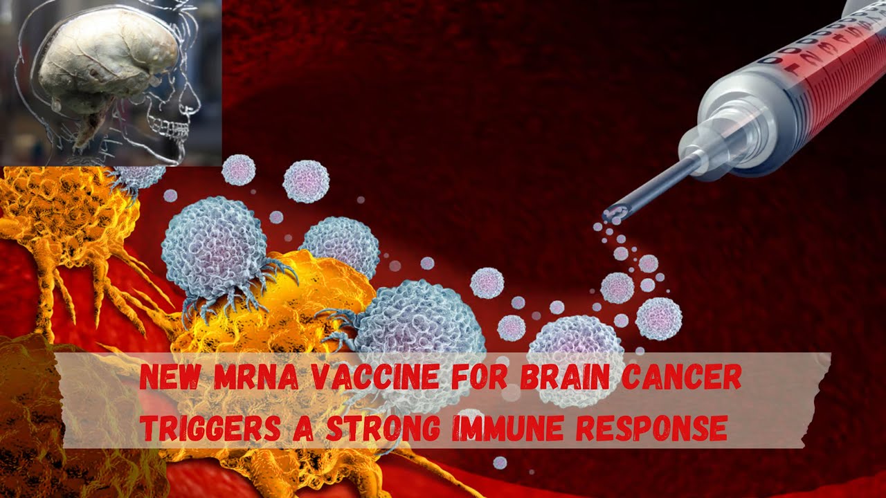 New mRNA vaccine for deadly brain cancer triggers a strong immune response