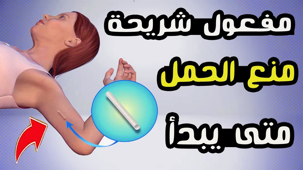 متى يبدأ مفعول شريحة منع الحمل؟