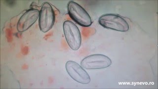 enterobius vermicularis oua