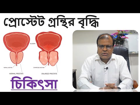 প্রোস্টেট গ্রন্থির বৃদ্ধি | প্রস্টেট গ্রন্থি বড় হলে | Enlargement of the prostate gland Bangla
