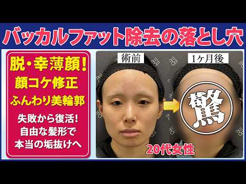 【症例解説】美容施術による頬コケ｜若い人ほど陥りやすい〇〇