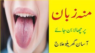 zaban aur Muh Ke Chale Khatam Karne Ka Gharelu Ilaj | Rehman Health Tips screenshot 5
