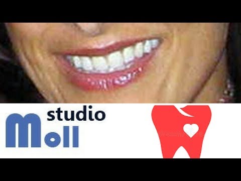 Video: Perché i miei denti sono deboli?