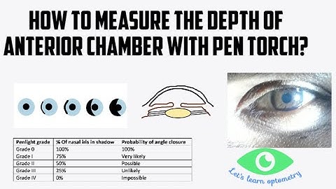 How to measure the depth of anterior chamber with pen torch?