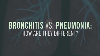 Bronchitis vs. Pneumonia: How are they Different?