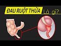 Sao ruột thừa lại nguy hiểm? Hiểu rõ trong 5 phút