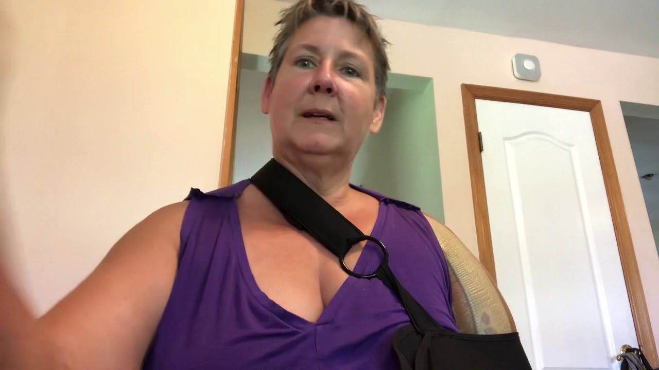 splinting humerus fracture splinting humerus fracture