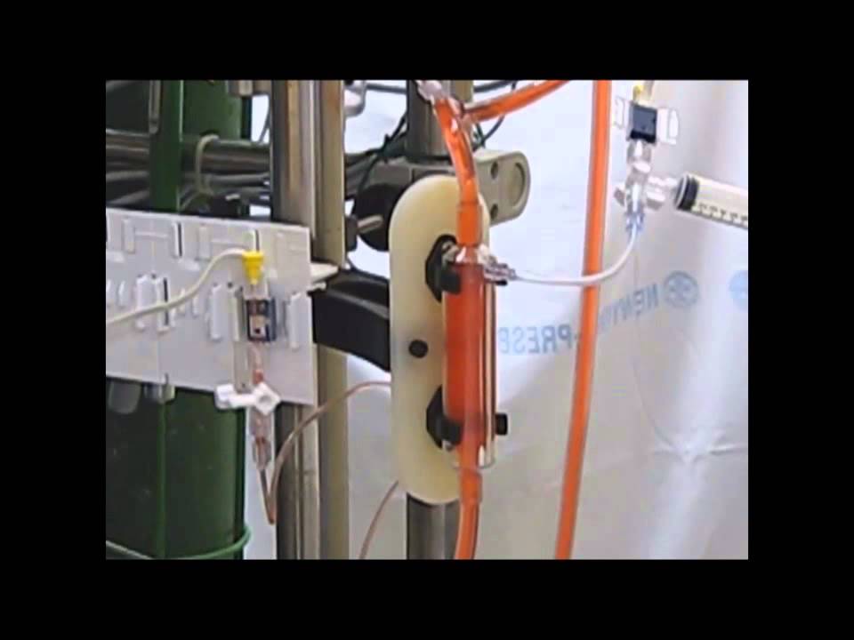 Pressure Testing Bladder Measuring venous line pressure with the Better-Bladder - YouTube