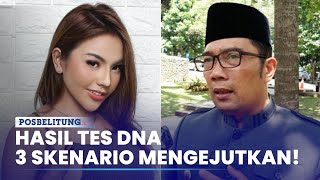 Hasil Tes Dna Ridwan Kamil-Lisa Mariana, 3 Skenario Mengaku, Terbuka, Atau Penjara