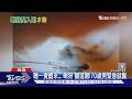 睡一覺「喇犽」鑽進眼!70歲男緊急就醫 醫師夾出殘骸嚇壞｜TVBS新聞 @TVBSNEWS01