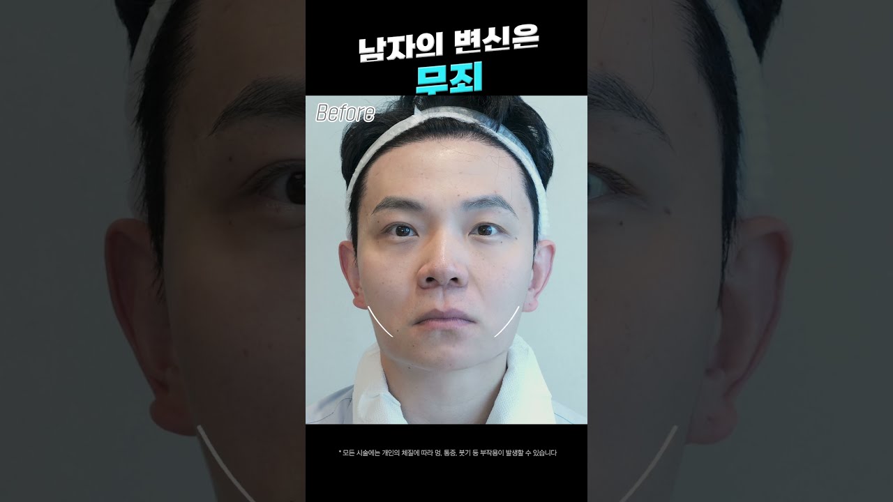 Лиэнжан Гоо сайхны эмнэлэг Термаж Лифтинг #шортс