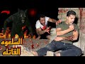 السلعوه القاتله كلت دراعي وخت العلاج علي اخر لحظه قبل متحول يحياا السبب 
