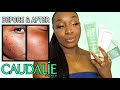 CAUDALIE PRODUCTS FOR ACNE & PIGMENTATION