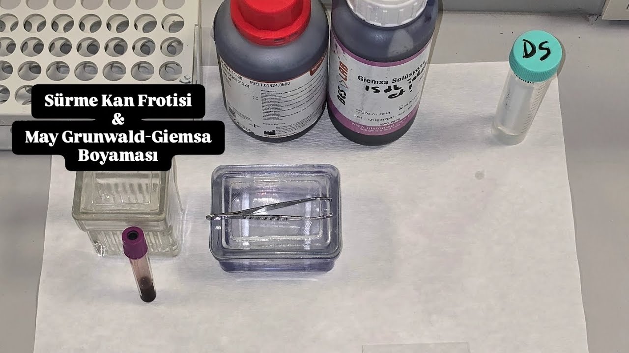 Sürme Kan Frotisi & May Grunwald-Giemsa Boyaması