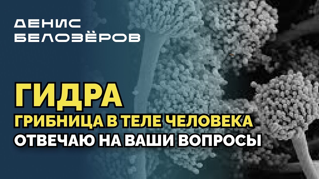 ГИДРА / ГРИБНИЦА В ТЕЛЕ ЧЕЛОВЕКА / Как от неё избавиться? Отвечаю на ваши вопросы. 