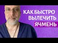 Ячмень на глазу Как лечить быстро - Доктор Елизаров