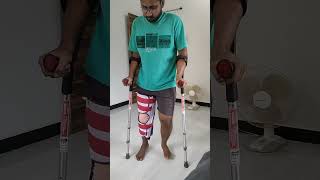 Pcl Surgery - Day 3 After Pcl Avulsion Fracture Fixation Surgery