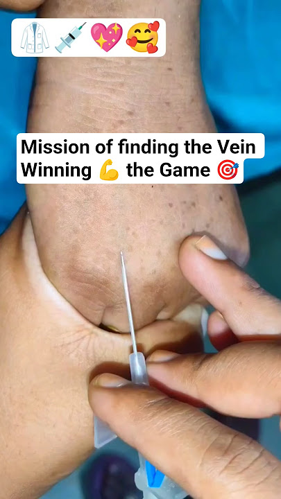Mission Cannulation π Finding the Vein Winning the Game #ivcannula #youtubeshorts #trending #shorts