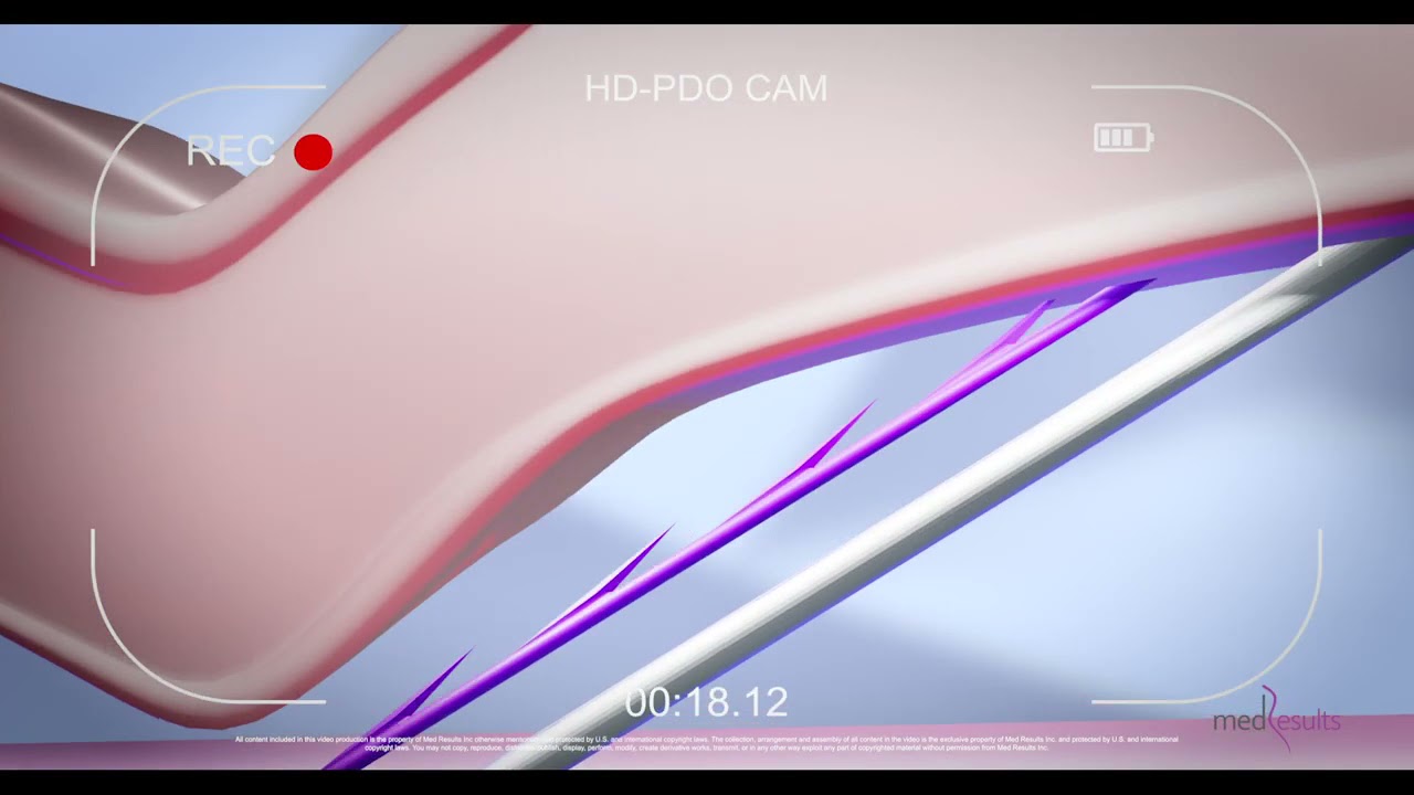 HDPDO Threads The Best PDO Threads on The Market YouTube