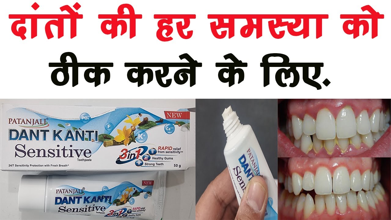 Dant Kanti Sensitive Toothpaste Ke Fayde दांतों का पीलापन,ठंडा गर्म