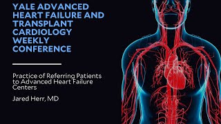 Practice of Referring Patients to Advanced Heart Failure Centers