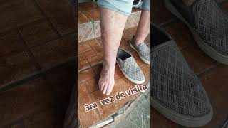 Testimonio Dulet En Varices Muy Avanzadas