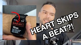 Anxiety and ectopic beats - reacting to my ectopic heartbeats using my Apple watch!