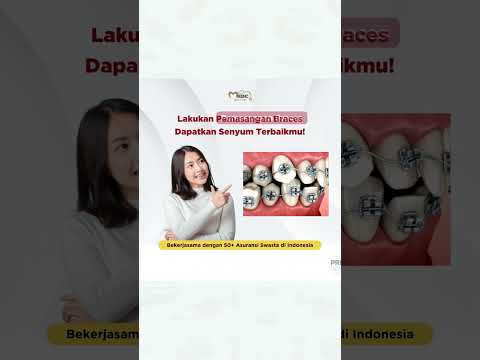 Pemasangan Braces lebih mudah dengan layanan Asuransi di MHDC Clinic!