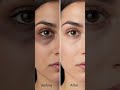 under eye cream #eyecream #undereyecream